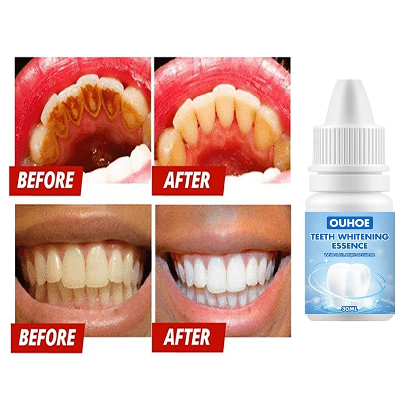 Teeth Whitening Essence Serum Bleach Powder Oral Hygiene Cleansing Remove Plaque Stains Fresh Breath Dentistry Dental Tools