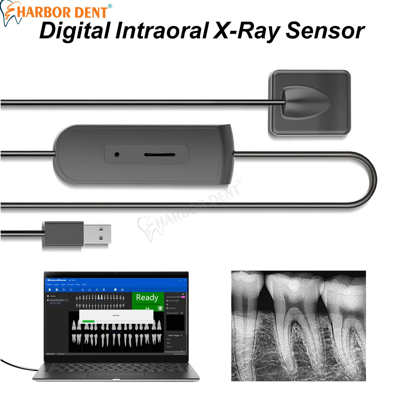 

Dental Digital Intraoral X-Ray Sensor HD Imaging System With Holder Faster Durable USB Dentistry Intra Oral Camera RVG Sensor