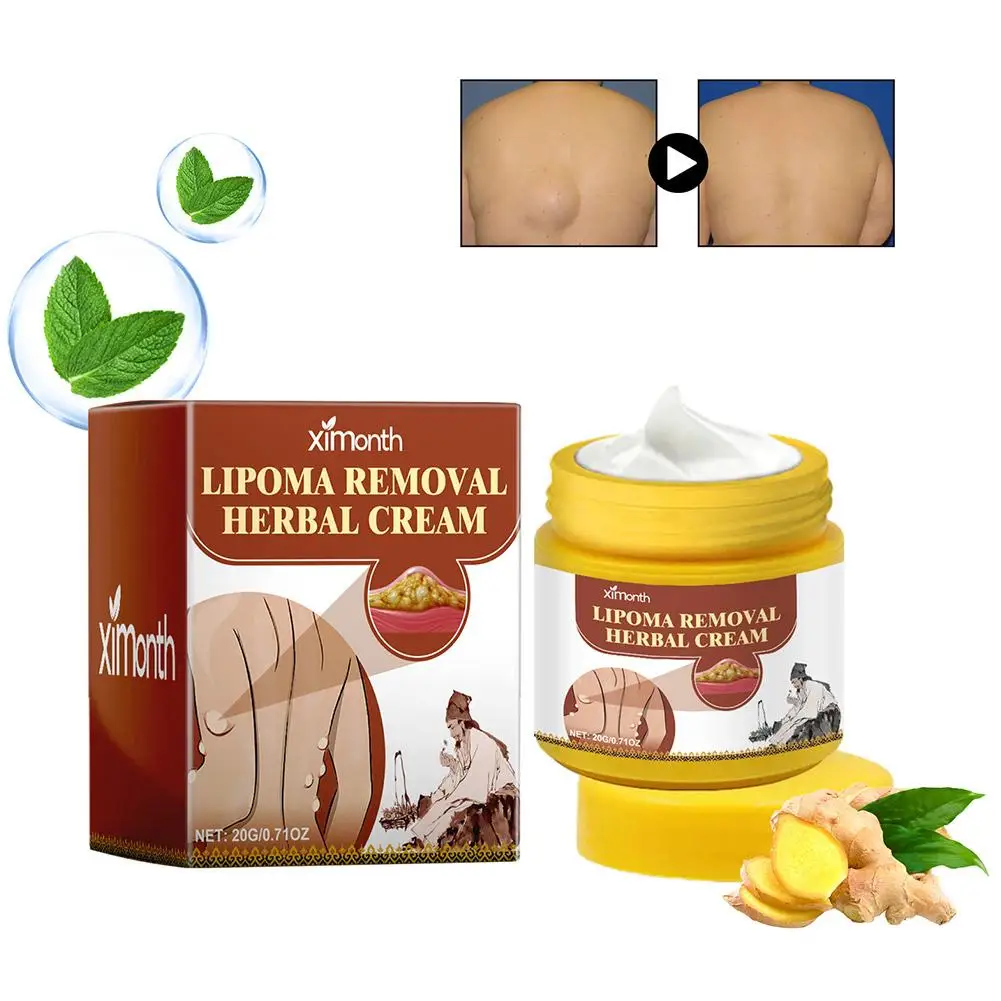 Creme Corporal Herbal Lipoma Removal, Dissolvendo Gordura, Fácil de Usar, 20g, 1Pc