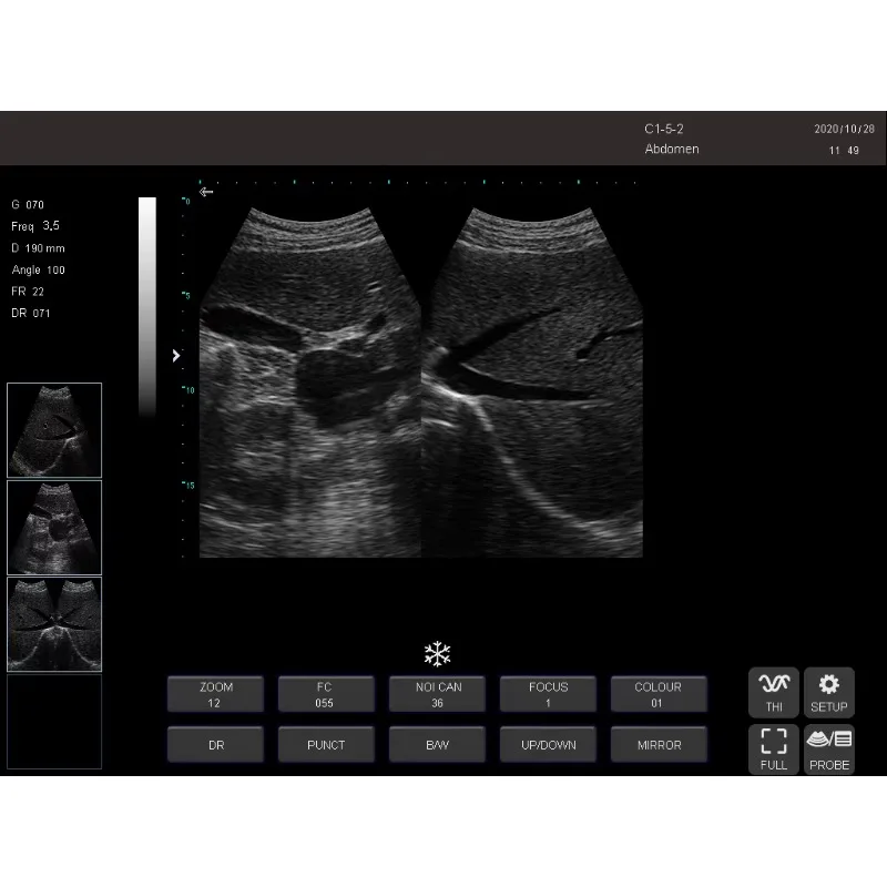Vet Equipment Ultrasound Diagnostic System Black And White Veterinary Ultrasound Scanner With Convex Array Probe