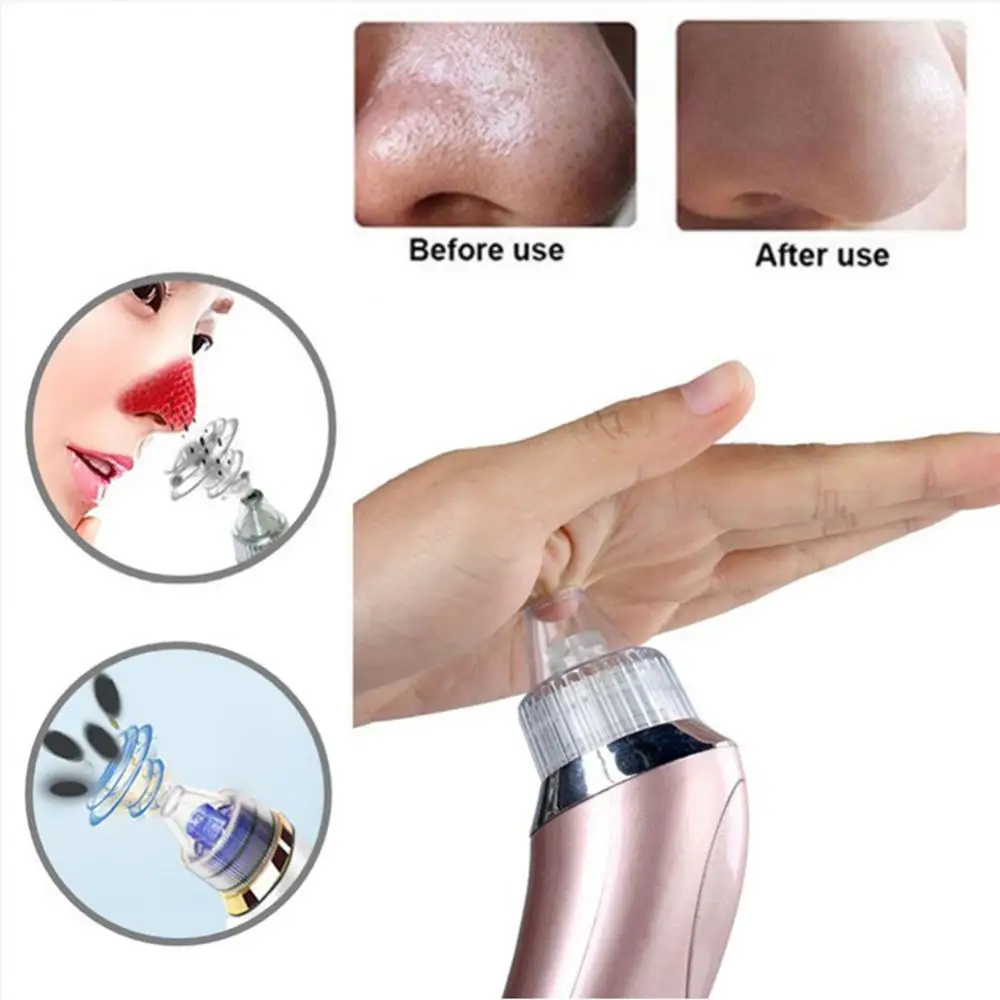 Cleaner Blackhead Remover Beauty Instrument Pore Vacuum Acne Pimple Black Spot Suction Electric Facial Skincare Exfoliating