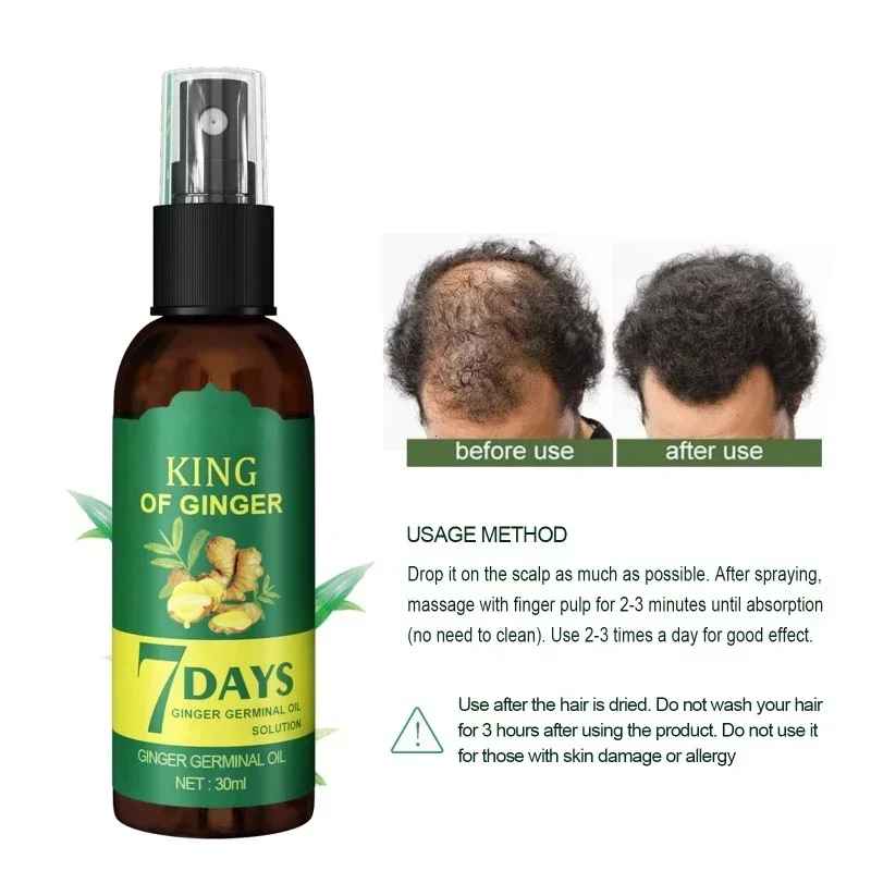 Suero para el crecimiento del cabello, aceite esencial para el cabello de rápido crecimiento, cuidado del cabello de belleza, 10/30/50ml, crecimiento denso, cabello de jengibre que promueve la regeneración