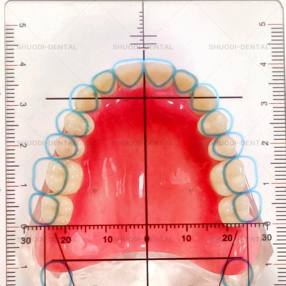 T Lab Guide Plate Laboratory Ruler Teeth Arrangement on Denture Work Lab Teeth Guide Plate Ruler Tool s