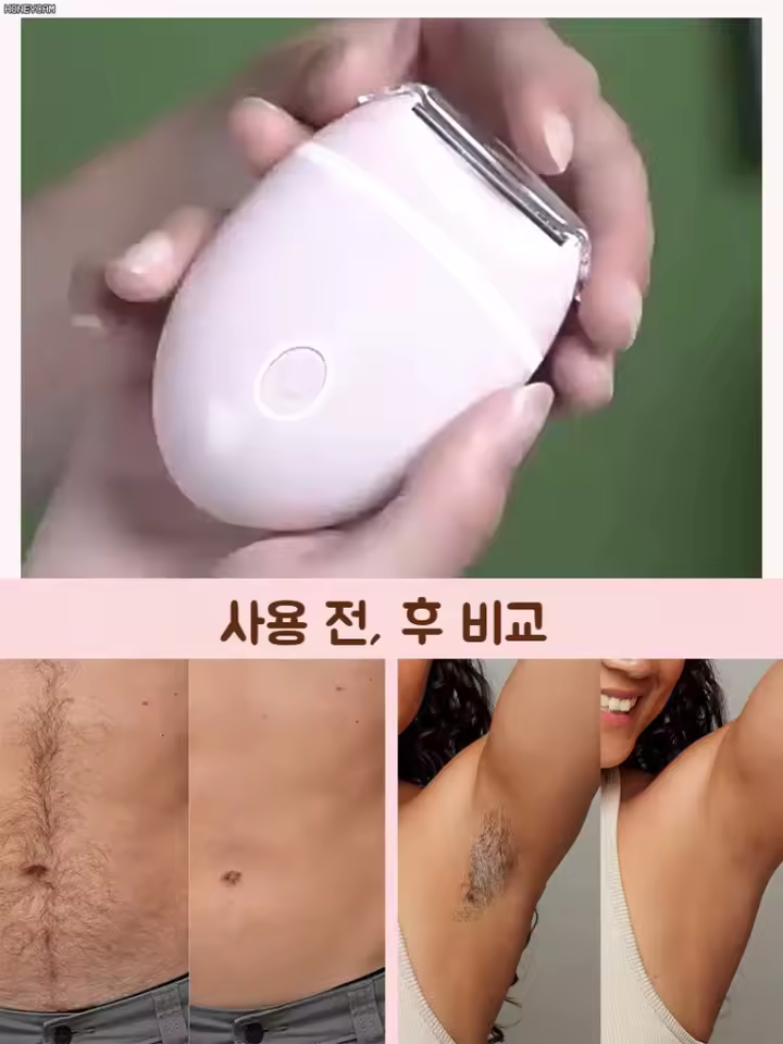 2. 여성 제모기 무..