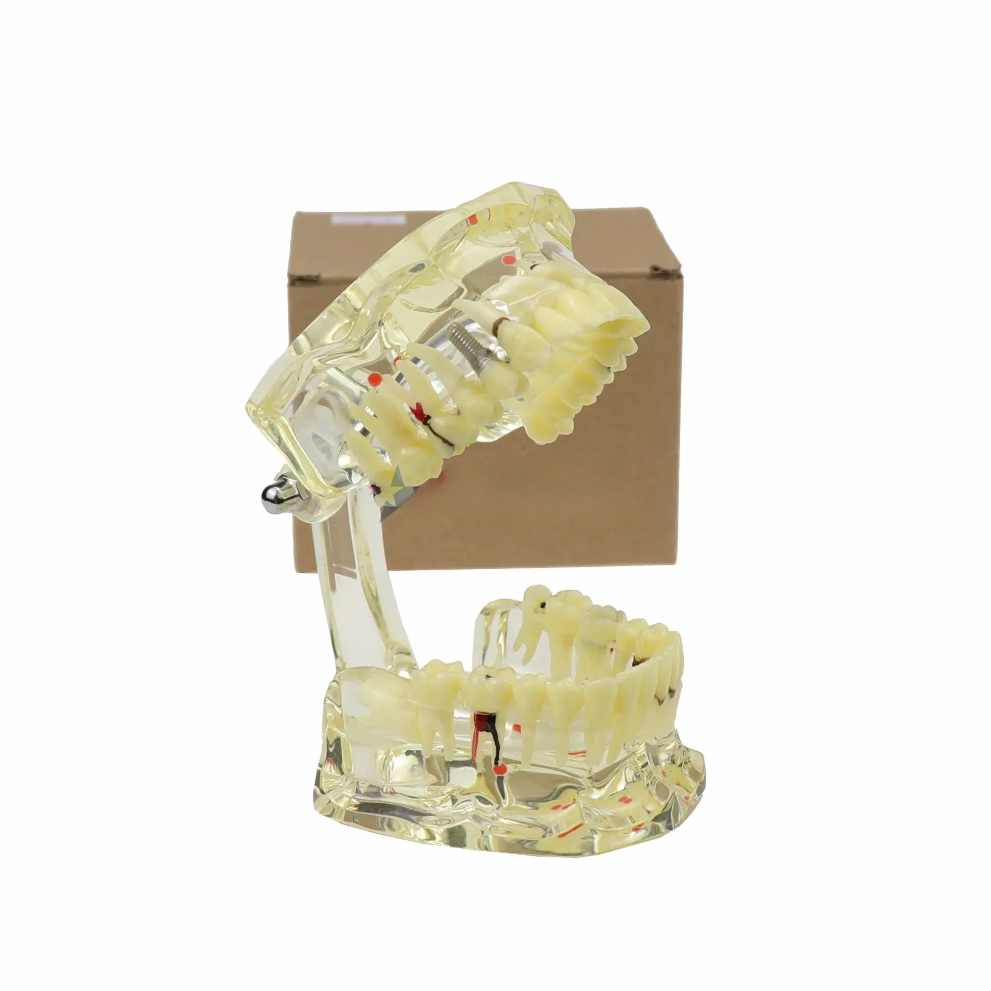 نموذج لشكل الأسنان الشفافة لعلم أمراض الكبار Typodonts يزراعة الحكومات نموذج الأسنان/نموذج أمراض الكبار #2