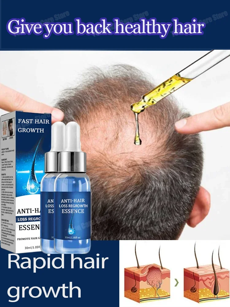 

Hair growth and anti hair loss serum, suitable for both men and women