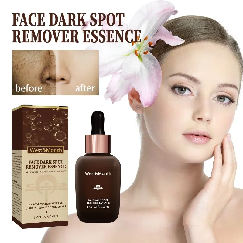 

Effective Whitening Serum Remove Dark Spots Freckle Essence Anti-Aging Fade Pigmentation Melasma melanin Brighten Skin Care