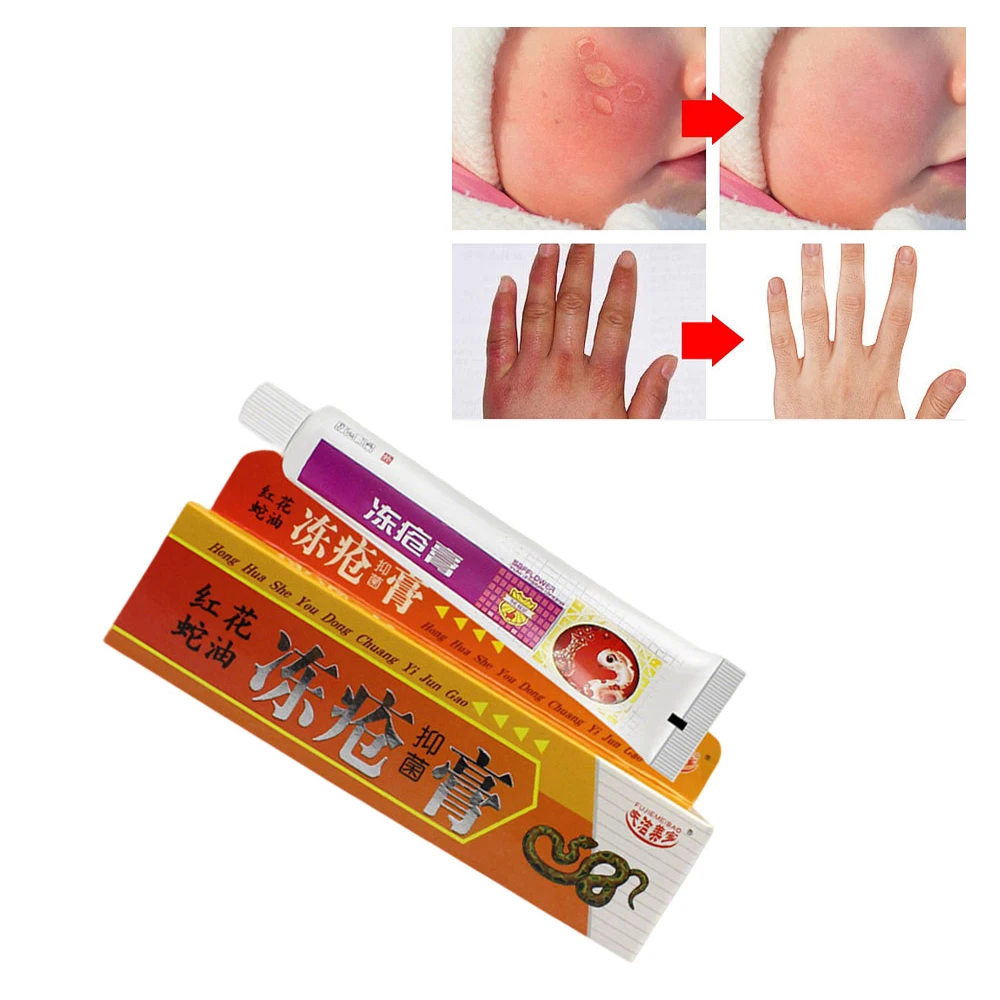 

Крем от морозу для ног, китайская медицинская мазь, крем от трещин для рук, пилинг, восстановление, зимний крем от трещин, крем против сухих трещин, 25 г