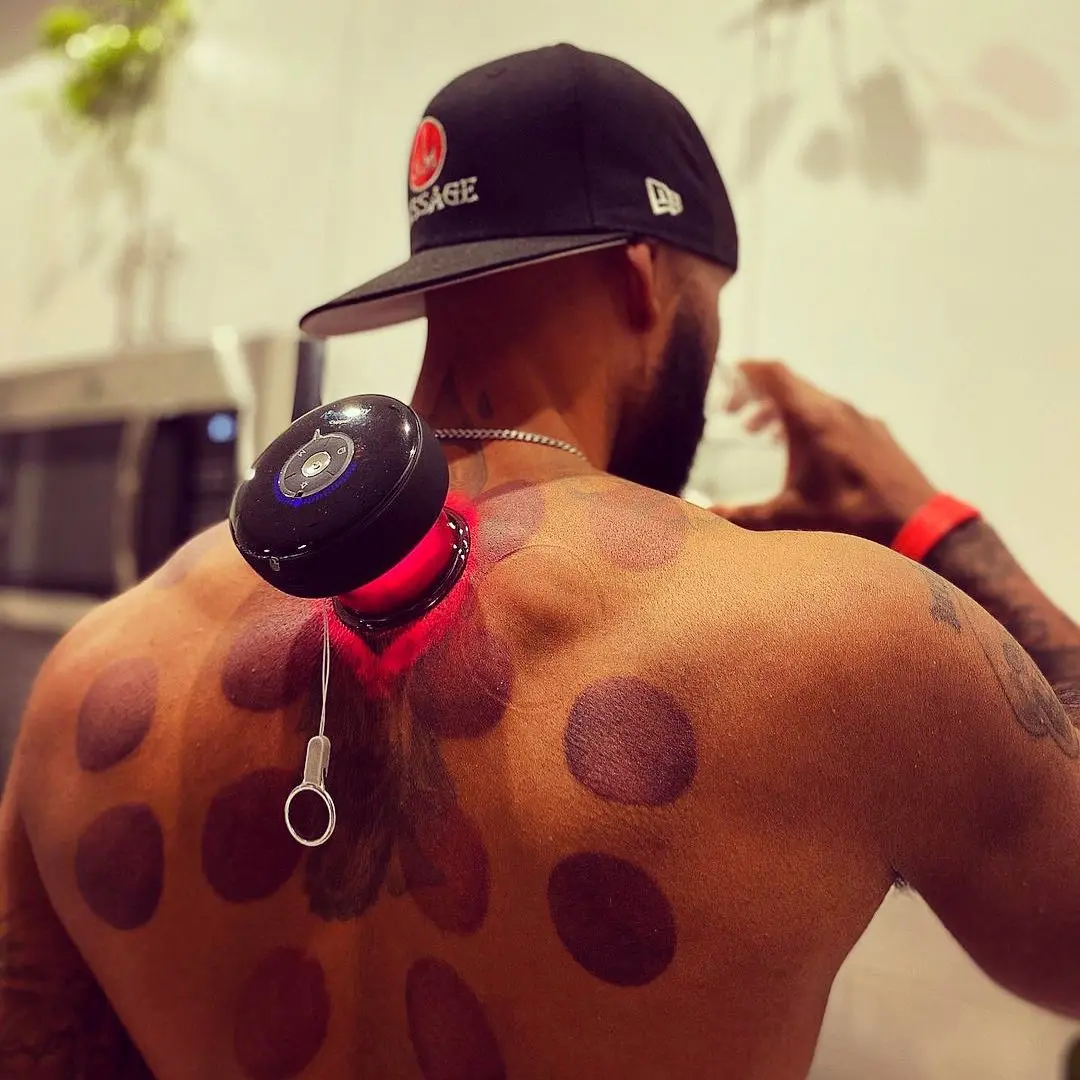 

New Patented Unique Trending Product Ideas Smart Cupping Machine