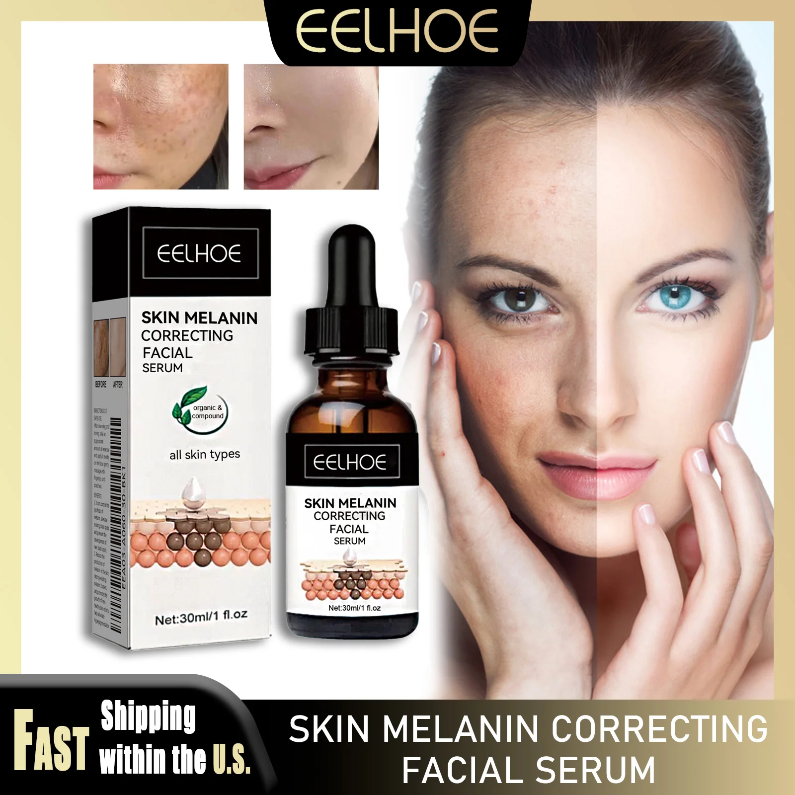 

EELHOE Melanin Correcting Serum 30ml Niacinamide Whitening Freckle Fade Dark Spots Moisturizing Shrink Pores Daily Facial Care