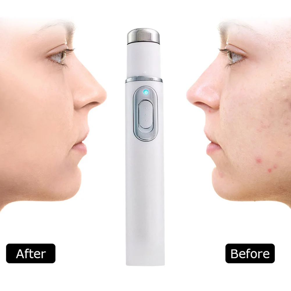 Dispositivo per la bellezza del viso Massaggiatore per occhi Luce blu Cerchi per occhi neri Strumento per la cura del viso Texture schiarente Manutenzione delle borse per gli occhi