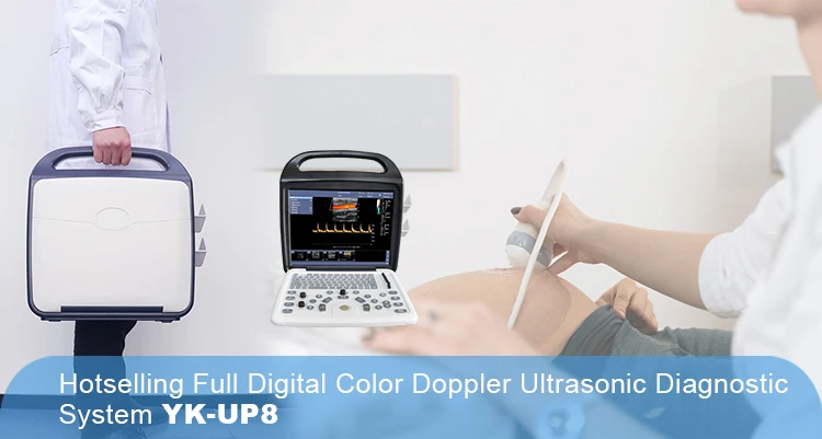 Yonker YK-UP8 Portable 64 Channels Ultrasound Machine Double Probe Interface Color Doppler Ultrasonic Ultrasound Machine