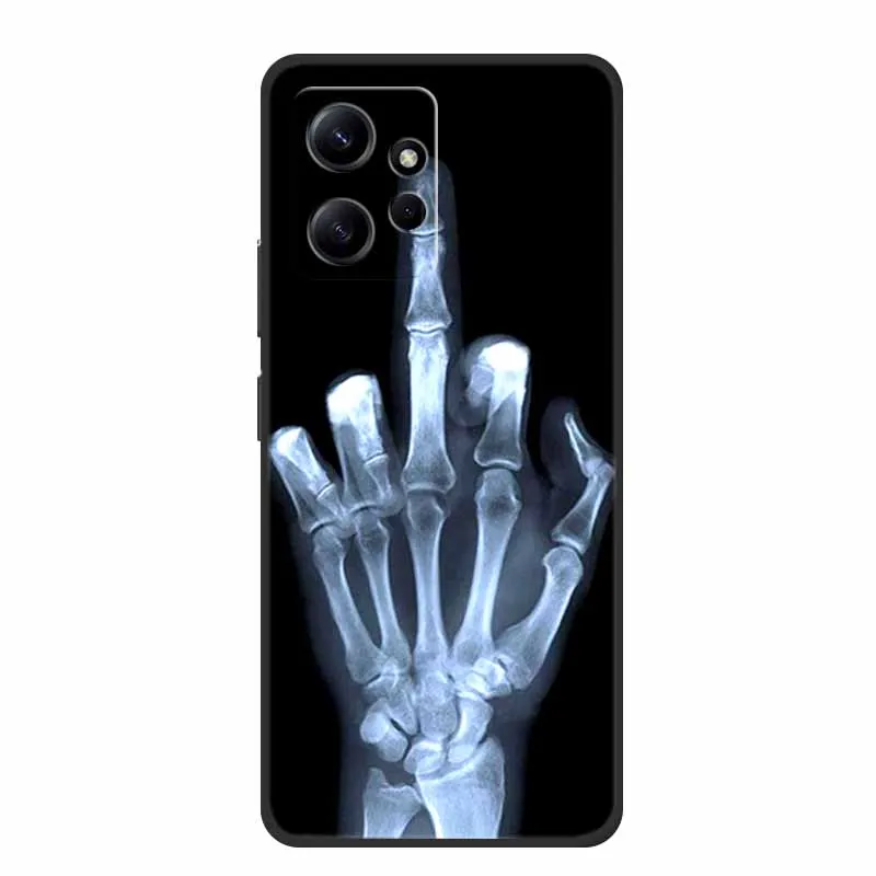 For Xiaomi Redmi Note 12 4G Case Animals Soft Silicone TPU Phone Cases Back Cover for Redmi Note12 4G Fashion 23021RAA2Y Fundas view 5