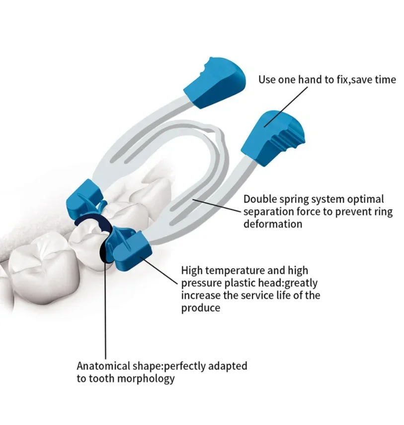 Tandheelkundige sectionele voorgevormde metalen veerclip Tandenvervanging Tandheelkundige matrixring Tandheelkundig gereedschap