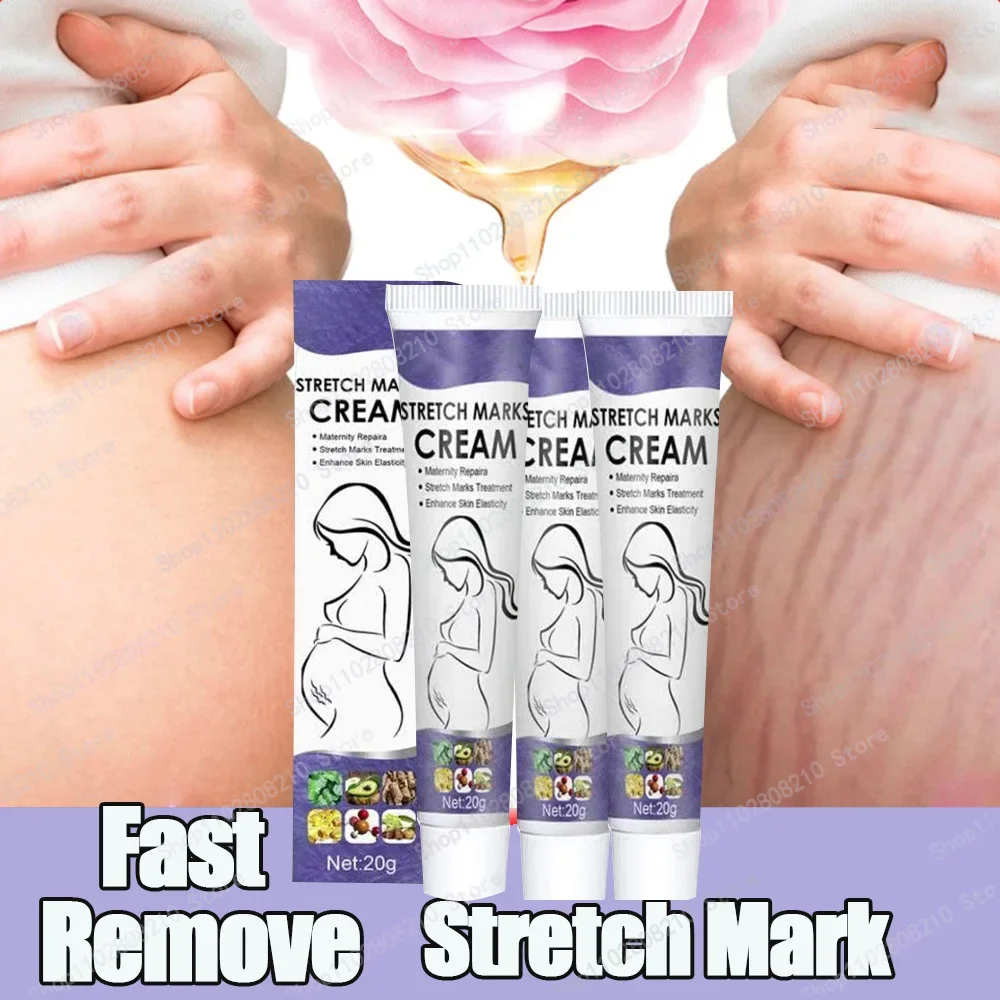 

Stretch Mark Removal Permanently Removes Stretch Marks Rejuvenates Skin Stretch Mark Removal