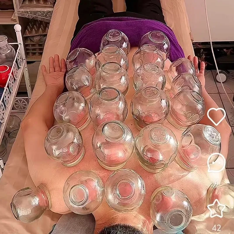 6 Pcs Set Body Gua Sha Therapy Glass Fire Cupping Chinese Medical Health Care Vacuum Cupping Instrument  6 Sizes Choose