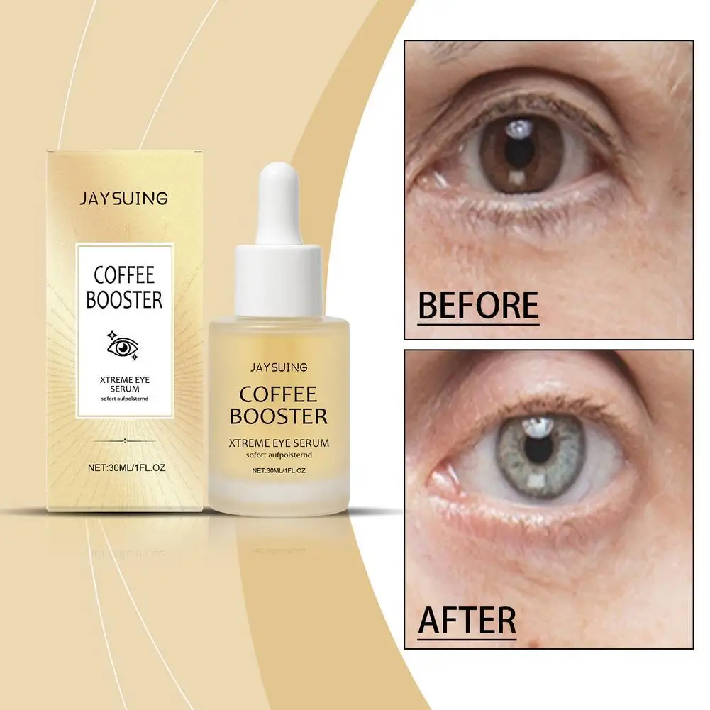 

30ml Eye Serum Nourishing Moisture Under Eye Roller Cream Massage Firming Serum For Dark Circles and Puffiness