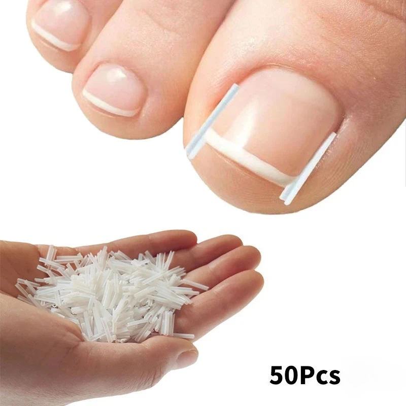 50-pecas-lote-ferramenta-de-correcao-de-unha-encravada-tratamento-de-unha-encravada-adesivo-elastico-clipe-alinhador-ferramenta-de-pedicure