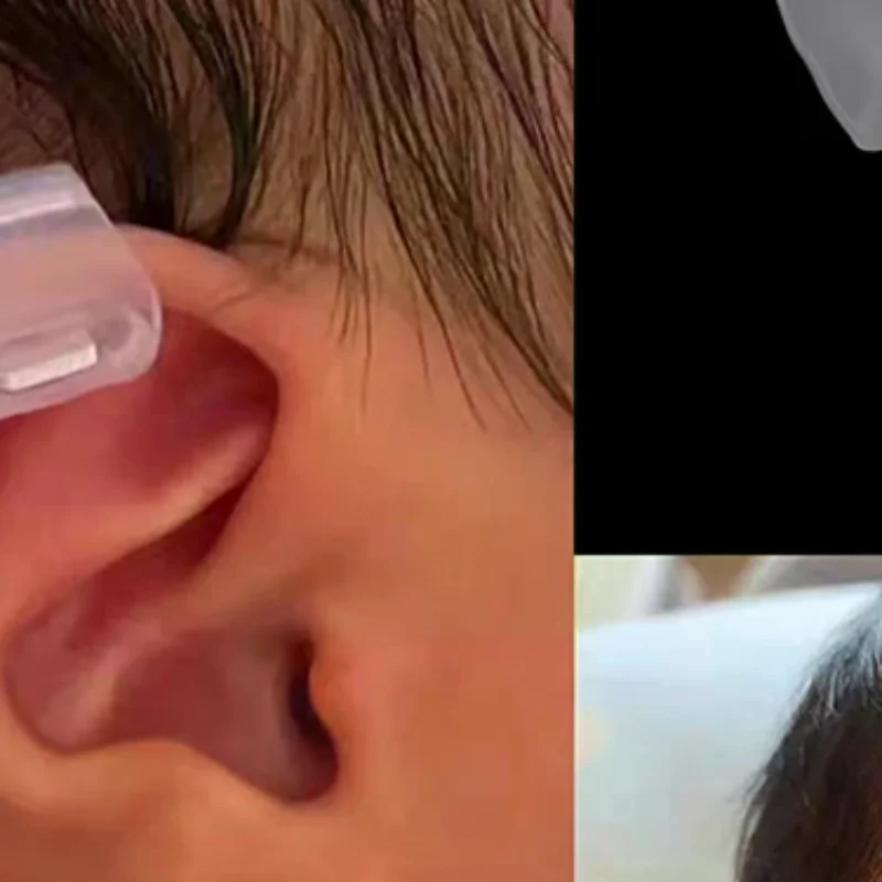 

1 шт., внешний корректор ушной раковины для детей, выдерживающий детский корректор ушей, детский внешний корректор ушной раковины, амбушюры