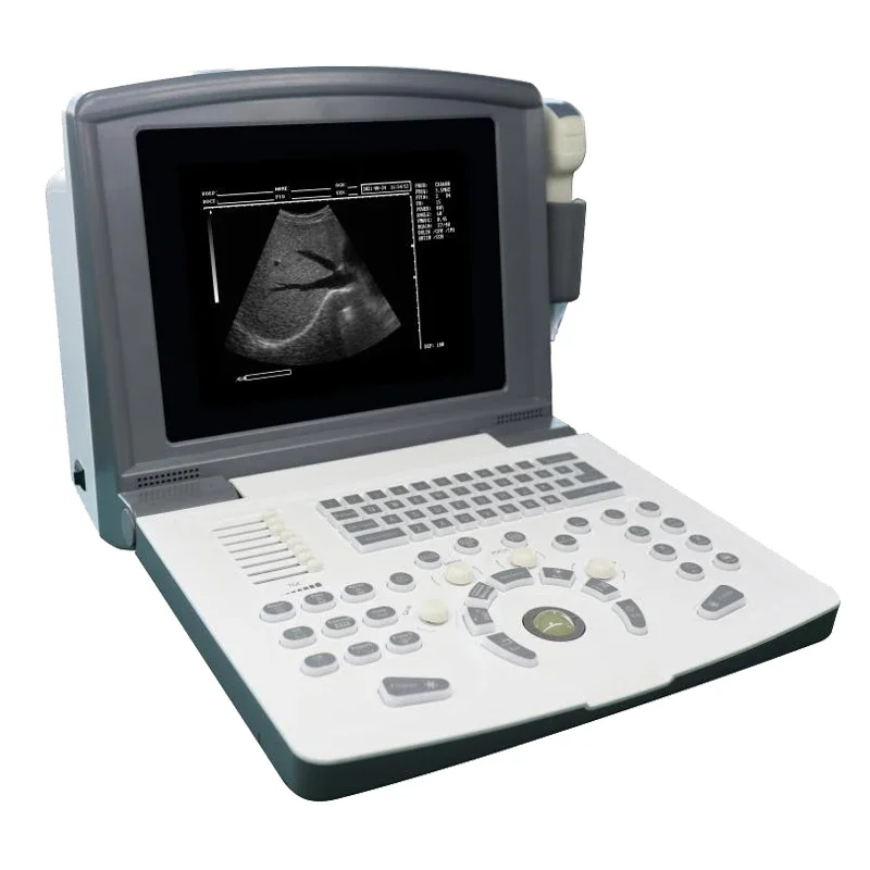 Factory Price  Color Doppler Ultrasound Scanner System Medical  Instrument Laptop  Probe