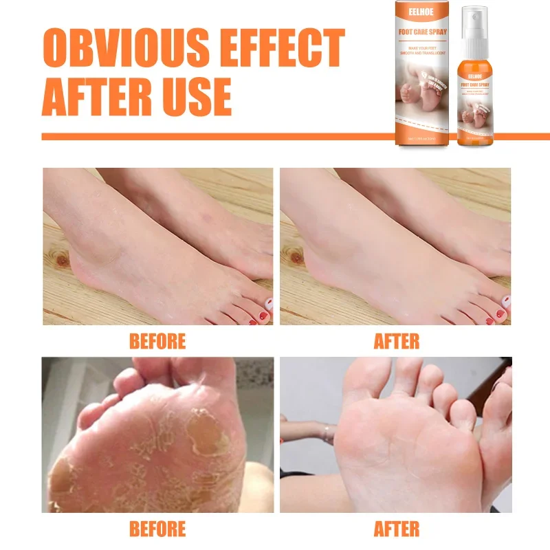 Foot Care Spray Heel Elbow Knee Exfoliating Anti-Drying Crack Peeling Removal dead skin Calluses Feet repair mask liquid