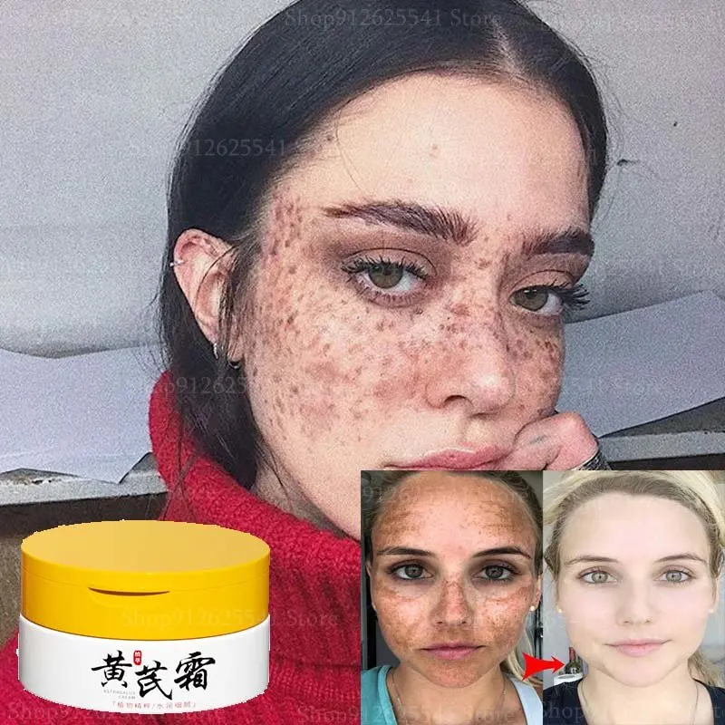 

70g Facial Moisturizing Astragalus Cream Remove Anti-aging Spot Face Care Fading Fine Lines Beauty Cream Skin Care Products