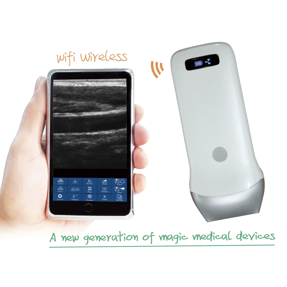 Potable Wireless Ultrasound Machine Pet Scanner WIFI Android IOS Windows Handheld Hospital Equipment Linear Scanner