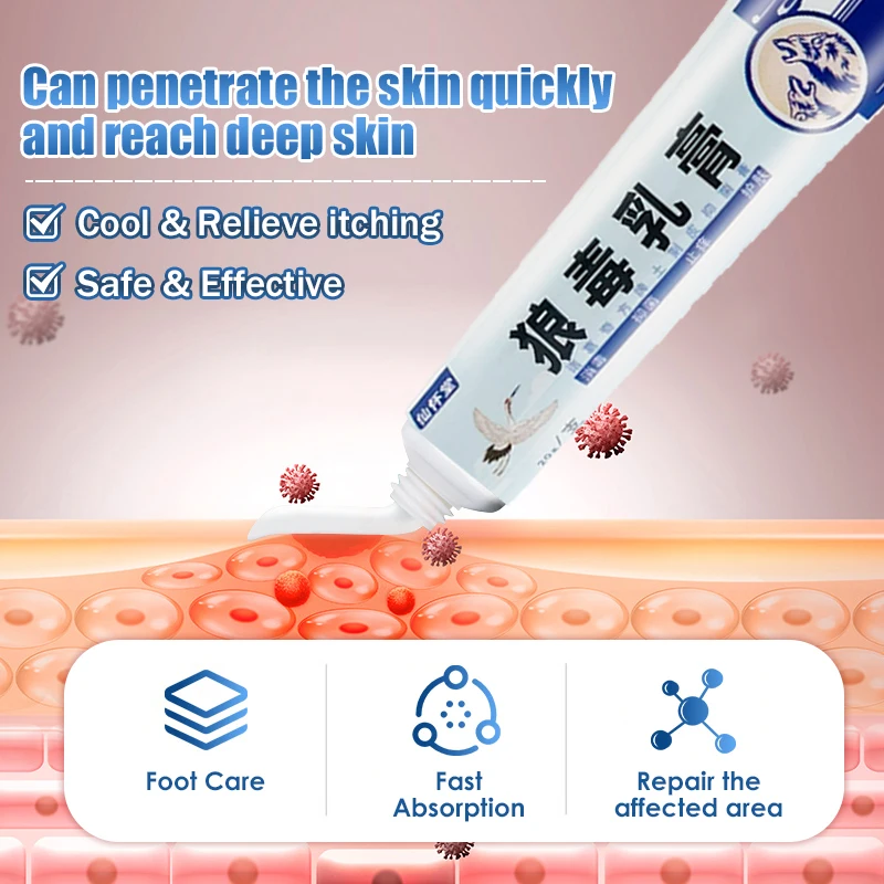 2pcs 20g Beriberi Cream Athlete's Foot Tinea Pedis Anti Infections Fungal Erosion Peeling Medical Dressing Antipruritic Ointment