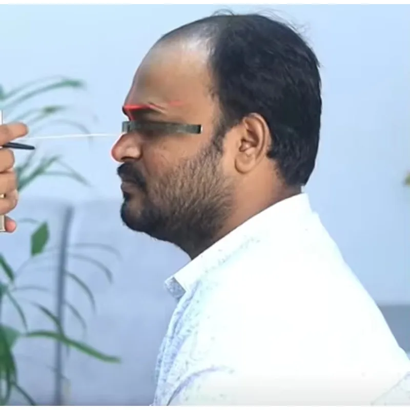 أداة قياس فروة الرأس الرقمية المعتمدة من CE للشحن السريع، مسطرة خط الشعر اليدوية لجراحة FUE، تصميم زراعة الشعر #5