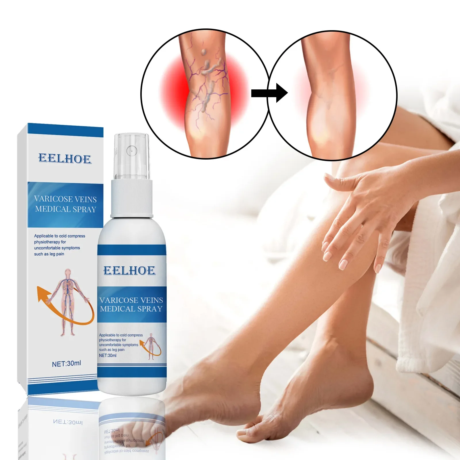 Venous Massage Spray for Relieving Varicose Veins, Smoothing The Bulge of Blood Vessels in Earthworm Legs Relieve Leg Pain