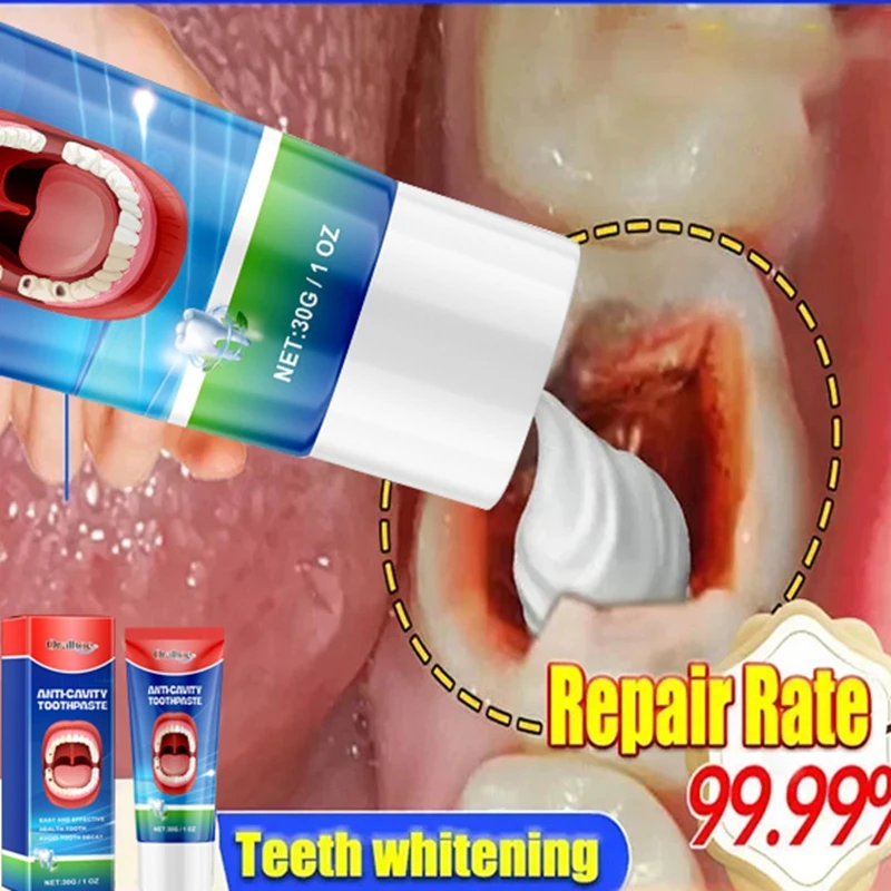 New Tooth Decay Prevention Toothpaste Effective Treatment Decayed Tooth Whitening Toothpaste Removal Yellow Toothpaste TeethCare