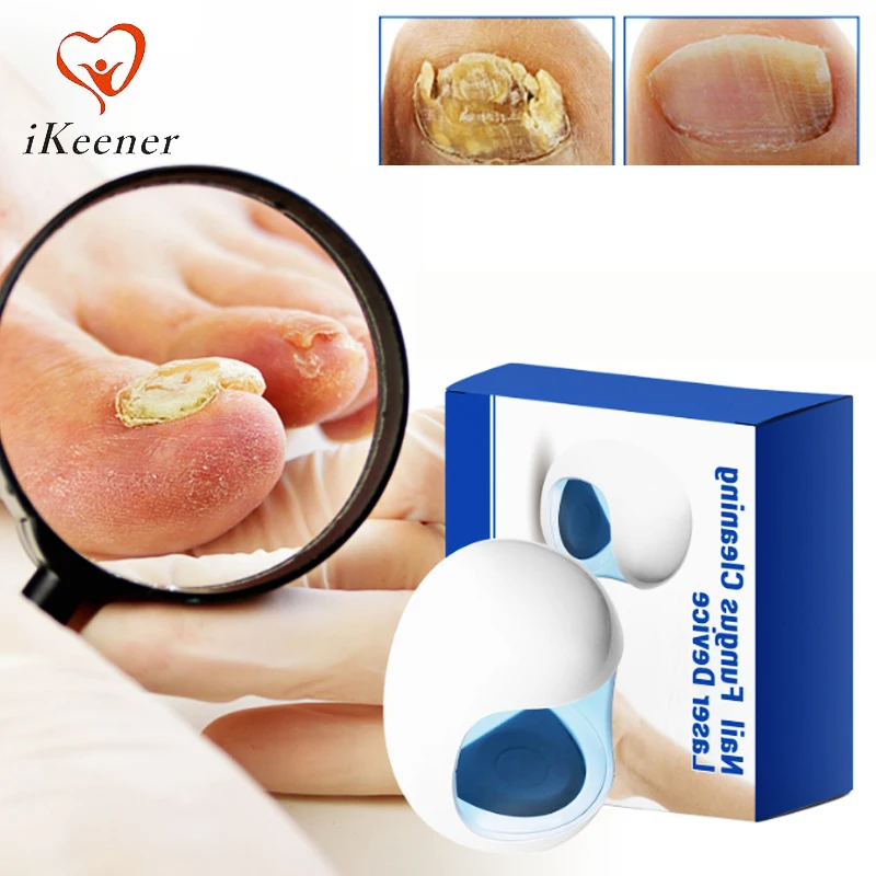 Onychomycosis Fungal Nail Laser Cleaning Repair Device for Toenail Fingernail Nail Fungus Foot Care Pain Relief
