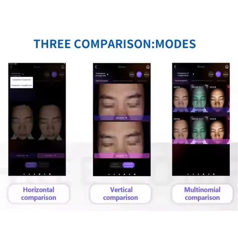 2 in 1 AI Visia Skin Analyzer 8 Spectrum 3D Facial Detector Scanner Intelligent Printable Report Product Recommendation