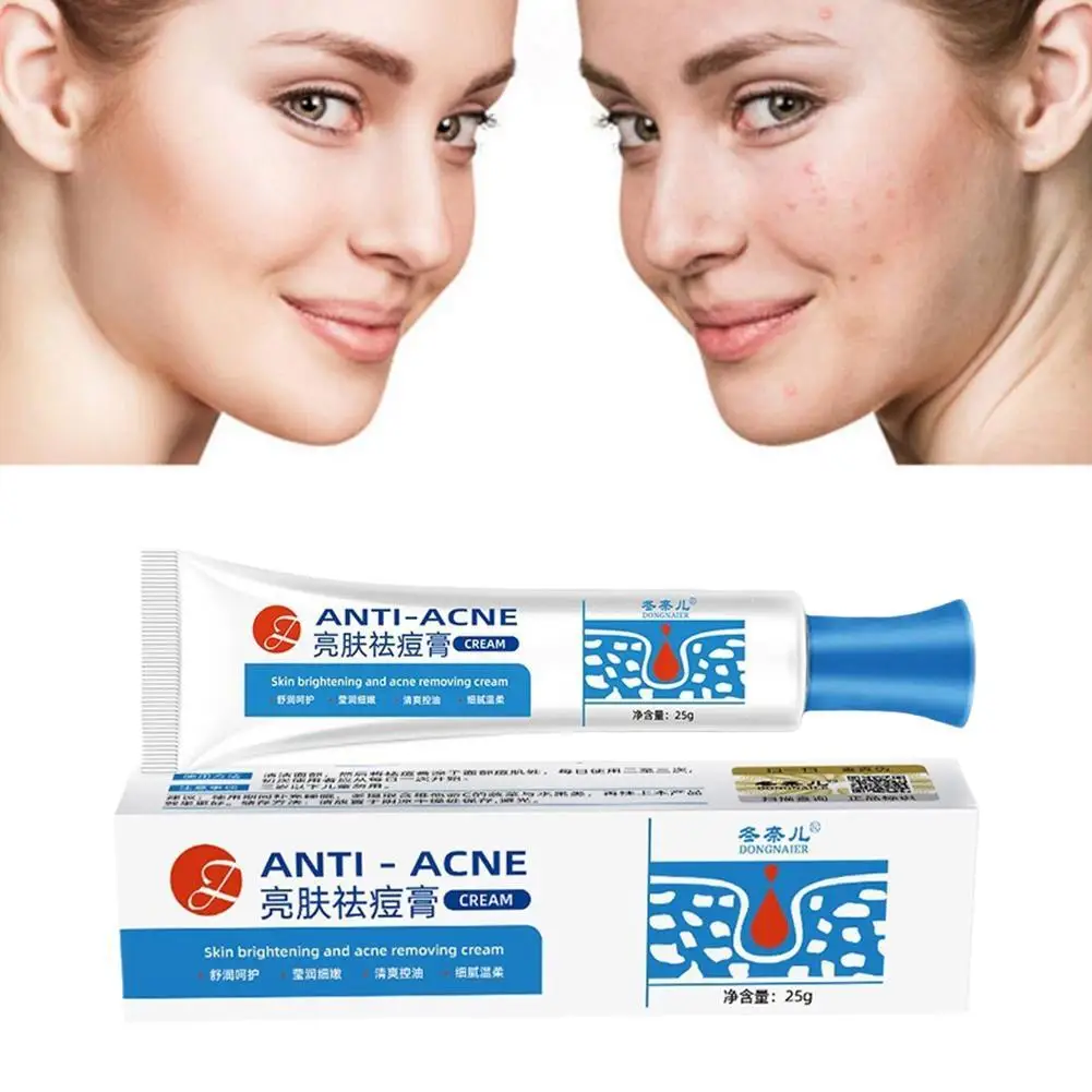 1/3/5 pçs remoção de acne creme facial natural acne beleza saúde anti-acne gel espinha remoção de manchas rosto cuidados com a pele suave sem estimulação