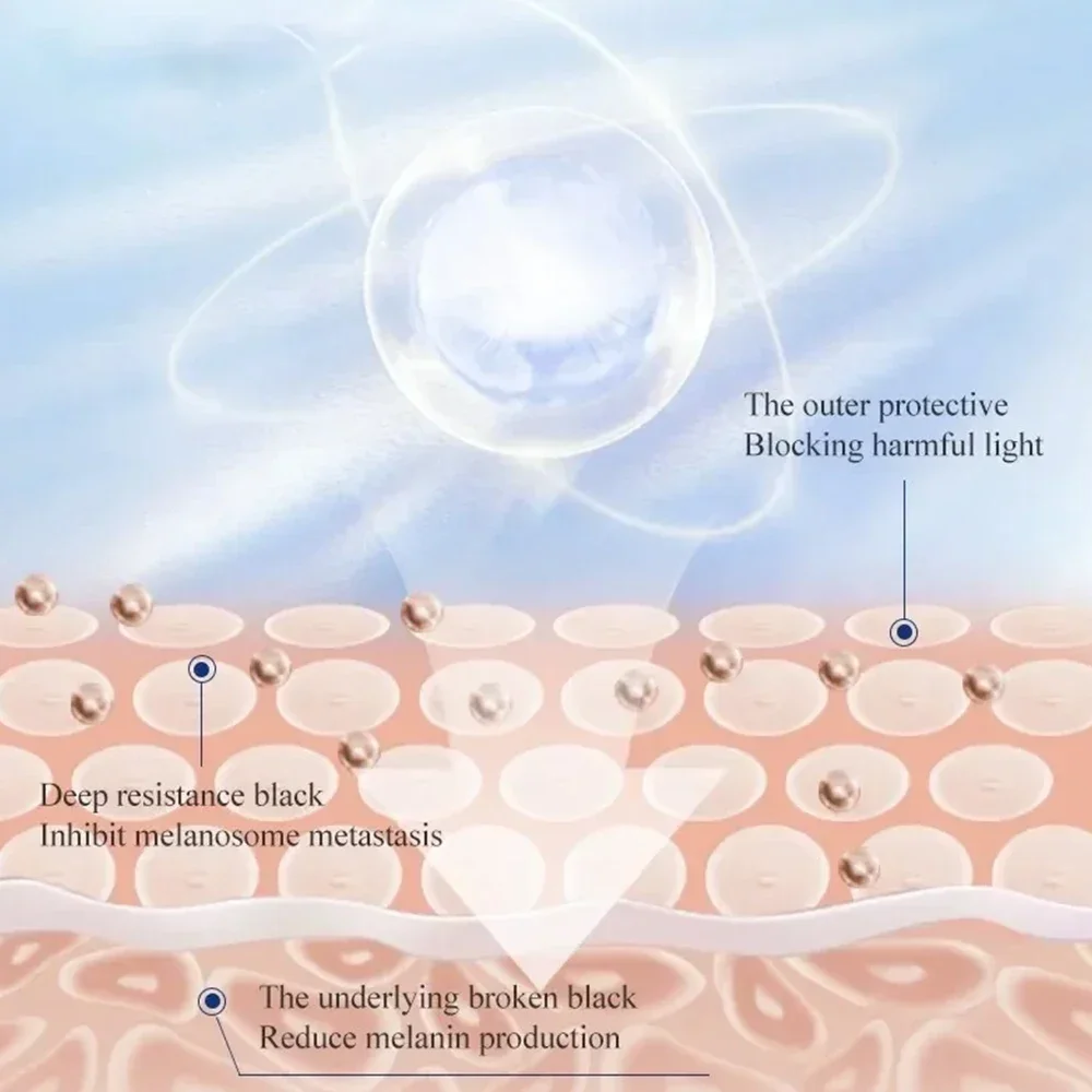 Melasma-creme clareador eficaz, remover manchas escuras, melanina, manchas solares, hidratação, iluminar, suavizar o cuidado da pele