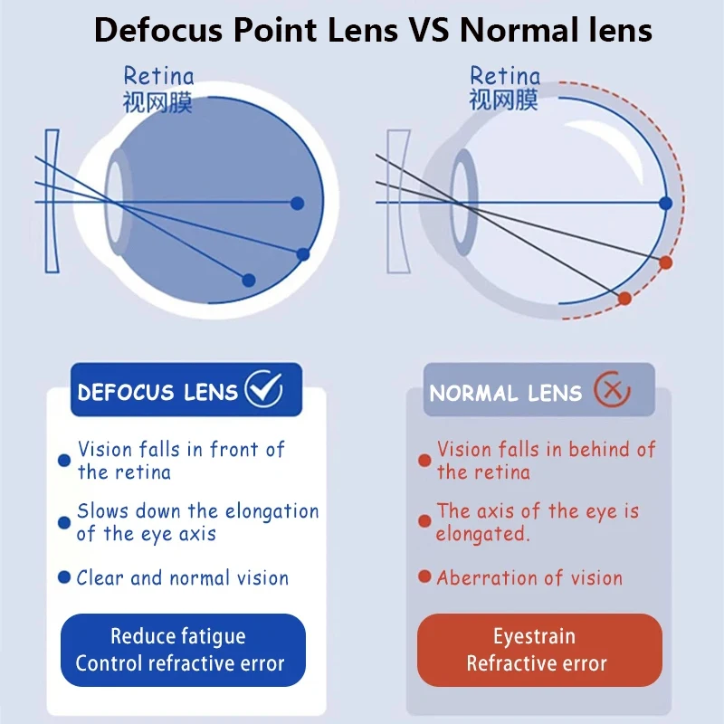 Teenager Myopia Control Lenses 1.56 1.61 1.67 1.74 Anti Blue Light Multi Point Defocus Prescription Lens Children Optical Glass