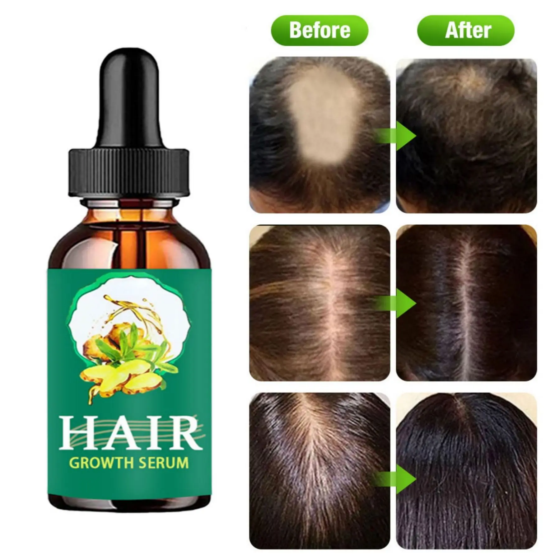 New Hair Growth Products Ginger Fast Growing Hair Essential Oil Hair Care Prevent Hair Loss Oil Scalp Treatment For Men Women