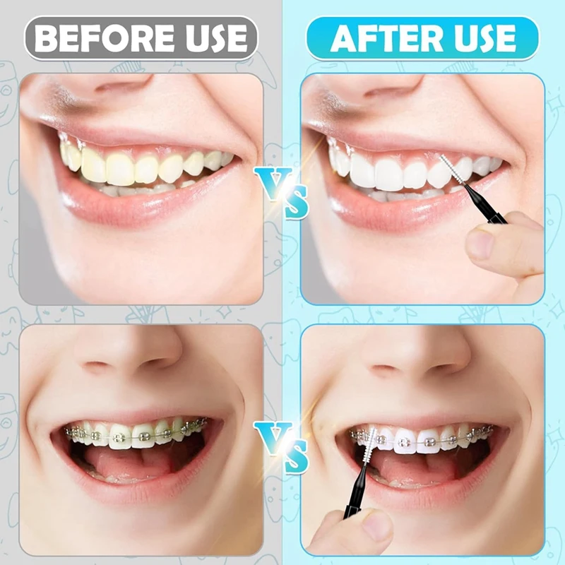 Top Deals 120Pcs Interdental Brushes, Braces Brush Cleaner For Teeth Cleaning Tools Spiral  Brush For Efficient Oral Care