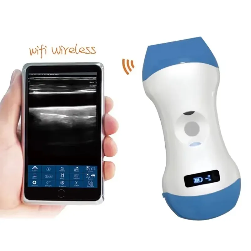 

2025/2025/Portable mini 80elements linear wifi wireless ultrasound machine probe handheld doppler ultrasound machine