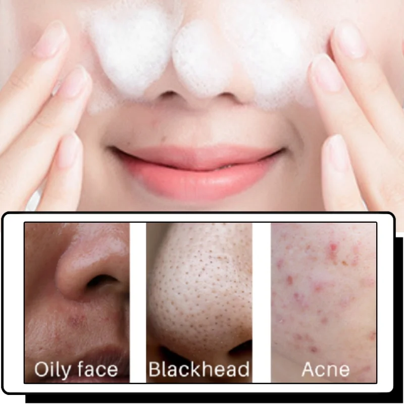 377 フェイシャルクレンザー オイルコントロール 毛穴洗浄 美白 保湿 メラニン除去