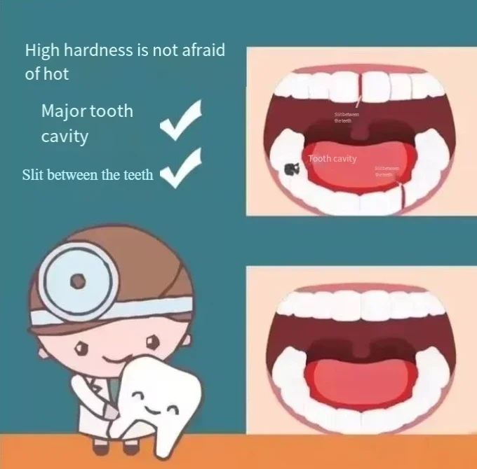 filling artifact Fill your own teeth at home Fill cavities Fill tooth holes Resin material Incisor sets