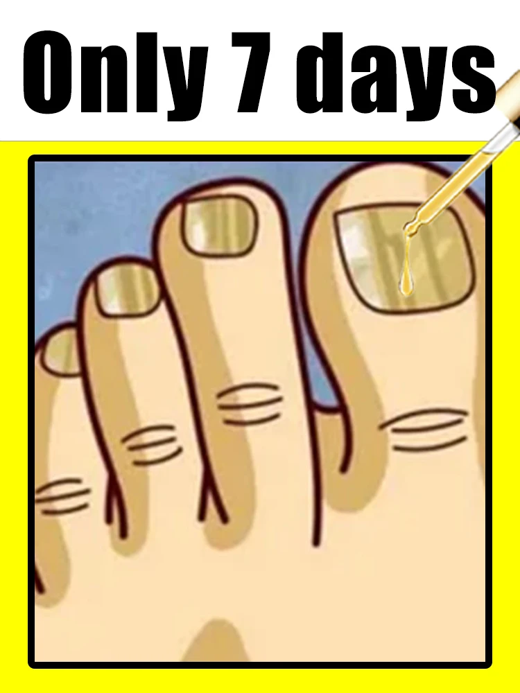 

Профессиональное обслуживание прощаются прощаются, чтобы утолщать, мутность и стральтацию и восстанавливает блеск. Самый популярный.