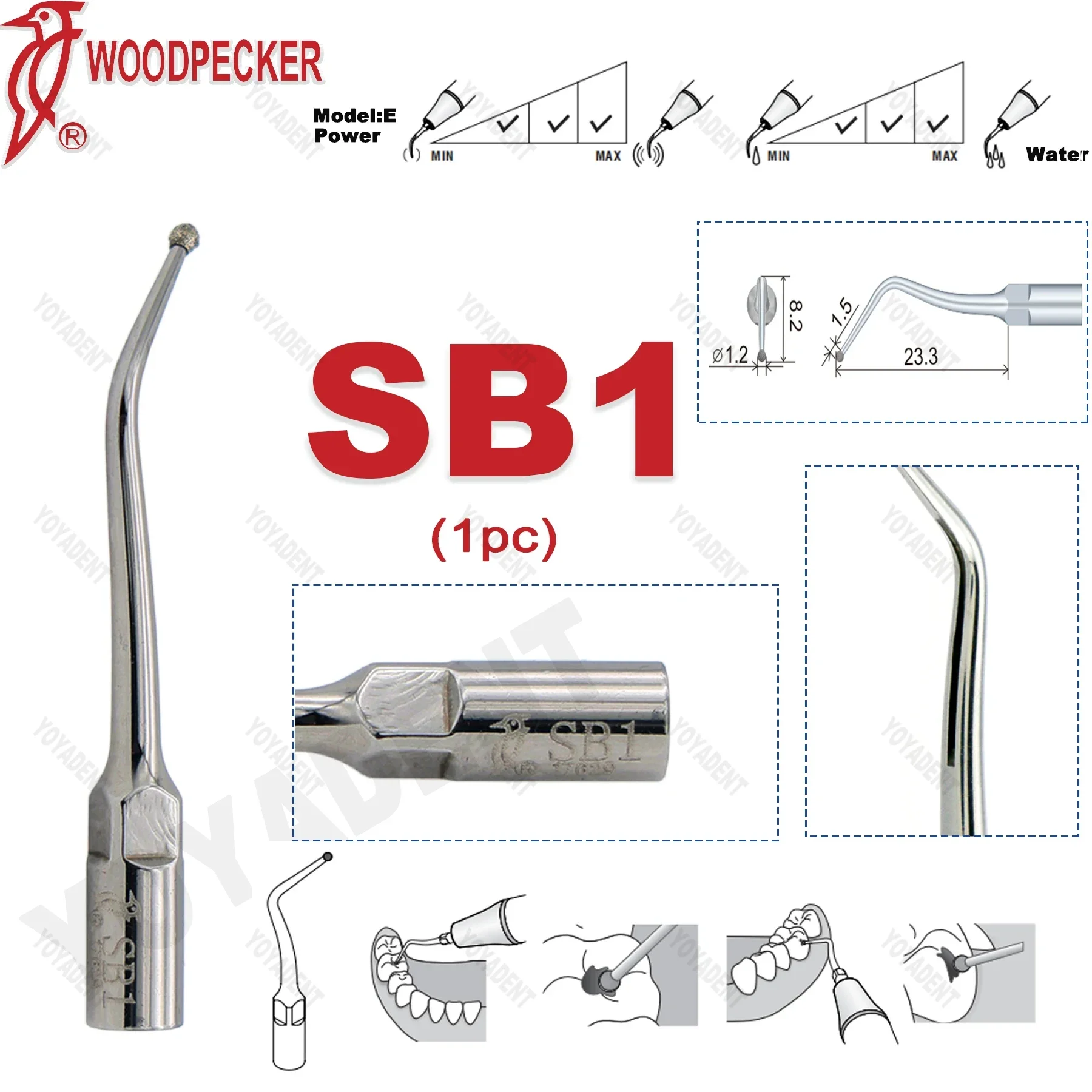 

Original Woodpecker Tips Dental Ultrasonic Scaling Tips Cavity Preparation Scaler Tips For EMS UDS Scaler Handpiece SB1