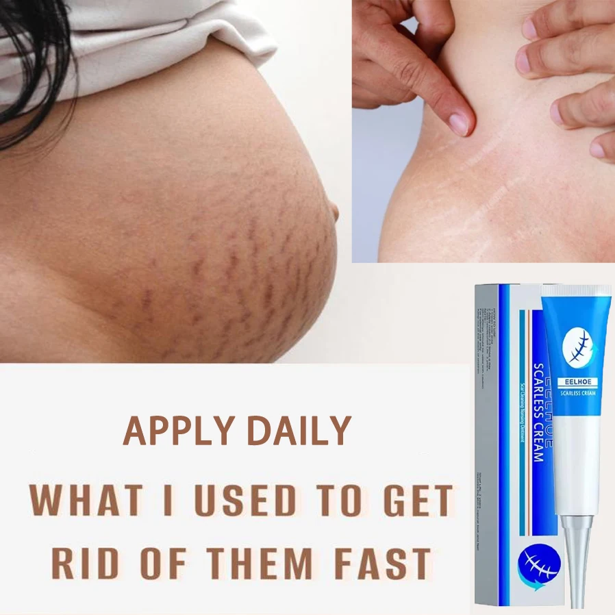 

Anti wrinkle face cream for pregnant wrinkles Skin repair protein for pregnant women Removing pregnancy scar Skin care