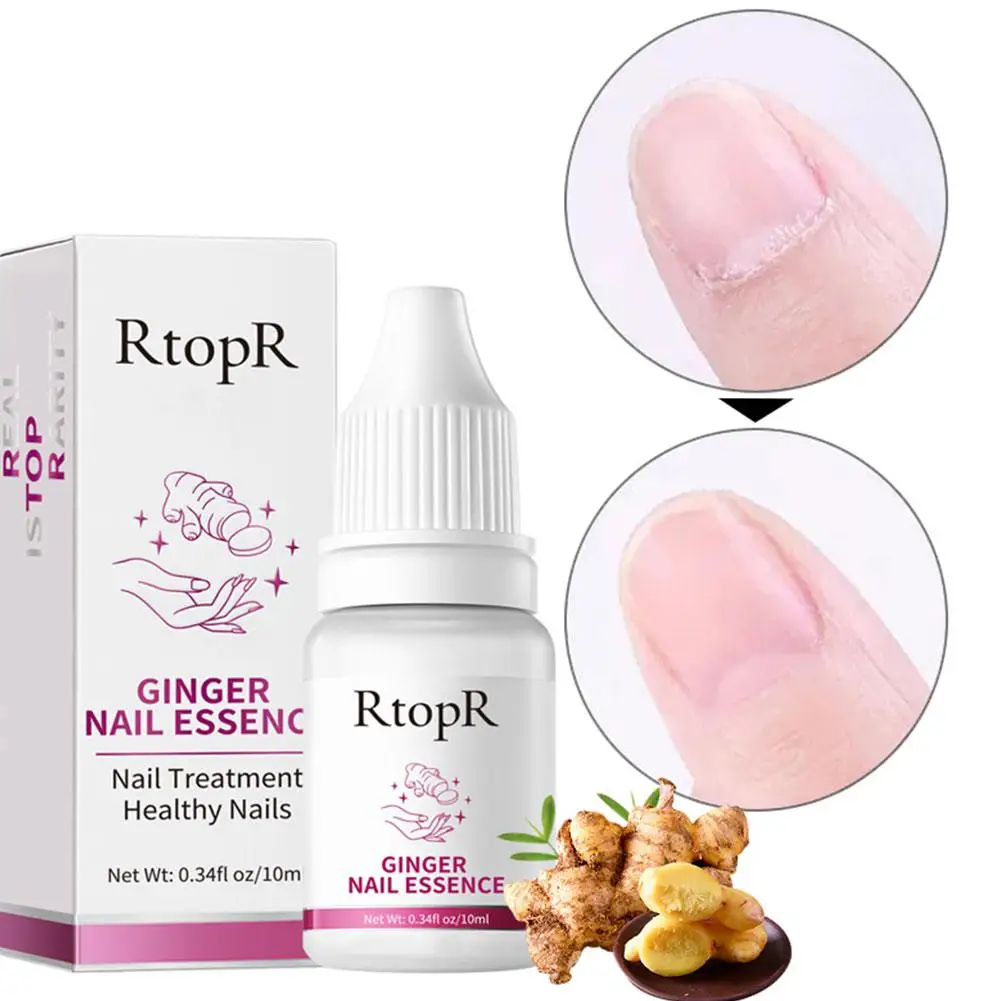 10ml Ginger Nail Essence Nourishing Rough Nails Anti Paronychia Thicken Crack Nail Fungal Nail Treatment Essence Hand Foot CARE