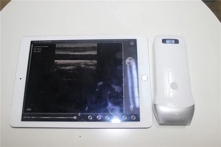 Portable ultrasound machine &wireless probe for phone/pad