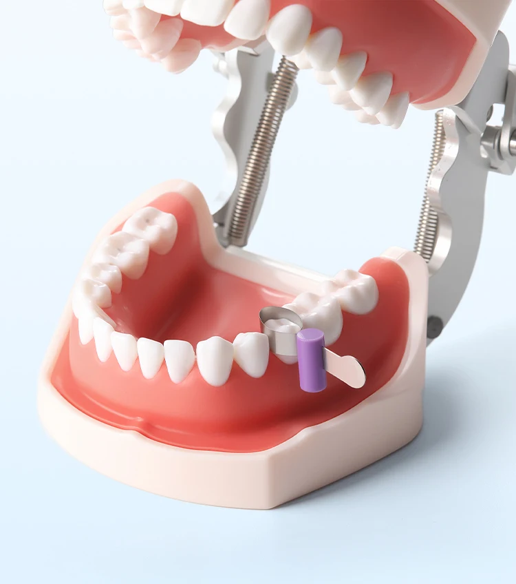 100 Stück AZDENT Dental-Matrixbänder, segmentierte, konturierte Metallmatrizen mit Positionierung, 5/6/7/8/9 mm Breite, für Zahnärzte und die Zahnmedizin. – Detail 10