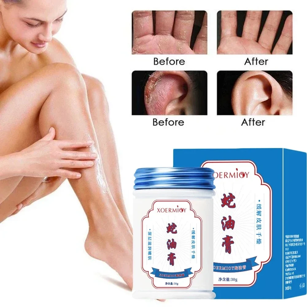 Herbal Anti Crack Foot Cream Heel Cracking Repair Products Exfoliation Dead Skin Removal Softening Moisturize Smooth Skin Care