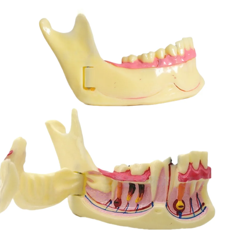 Dental Low Jaw Endodontic Model Anatomical Model of Right Mandibular Tissue Anatomical of Gingiva for Learning And Teaching