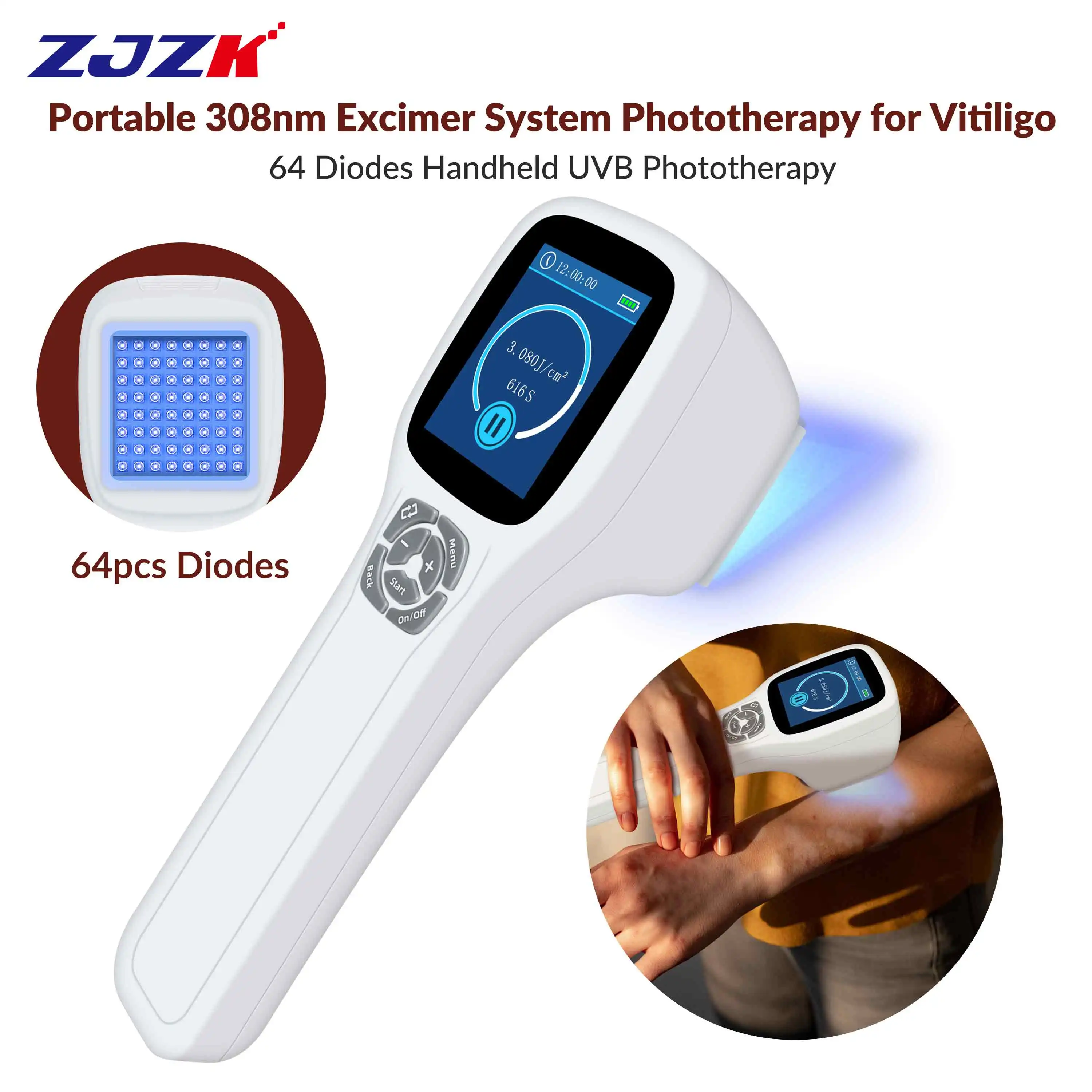 ZJZK Vitiligo Light Therapy At Home Blue Light Facial Benefits 308nmx64diodes Pdt Blue Light Before And After Rose Psoriasis